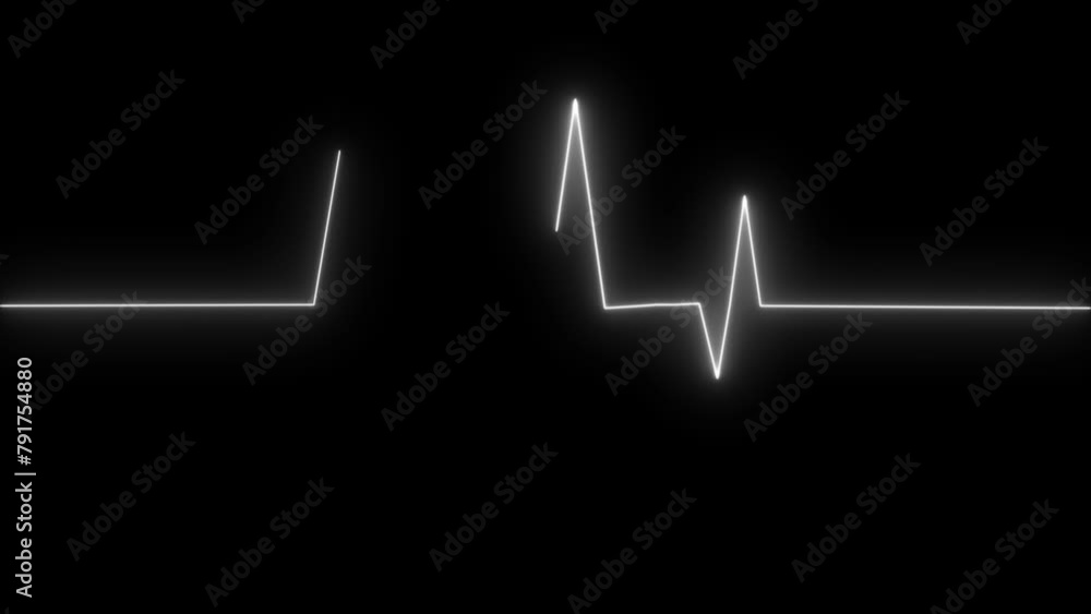 Heartbeat Monitor Animated Video, Heartbeat Medical Cardiogram Animation. Heart rate monitors electrocardiogram Heartbeat Monitor Animated Video, Heartbeat Medical Cardiogram Animation. Heart rate monitors electrocardiogram