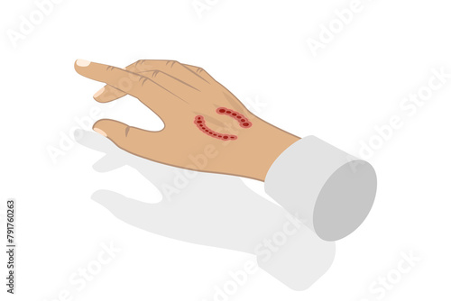 Принти на полотні 3D Isometric Flat  Illustration of Dog Bite, Rabies Virus