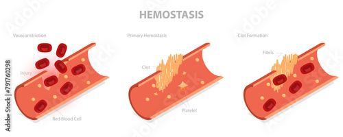 Obraz na plátne 3D Isometric Flat  Illustration of Hemostasis, Wound Healing Process