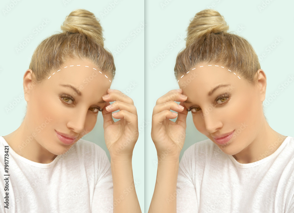 Thinning hair and hair loss,female pattern baldness,Hair transplant Thinning hair and hair loss,female pattern baldness,Hair transplant