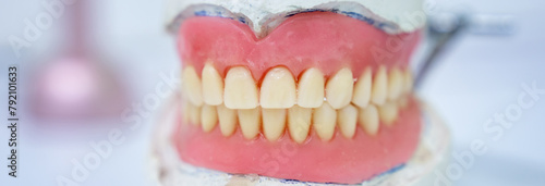 Dental prostheses, dental concept. stock photo