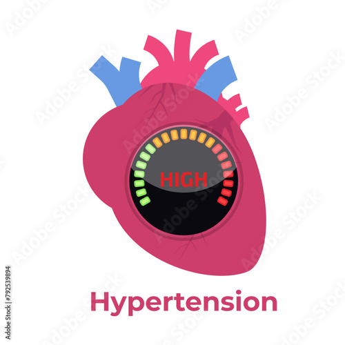 High blood pressure, hypertension concept. Vector illustration.