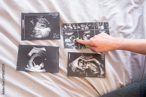 Expectant Mother Reviewing Ultrasound Images photo