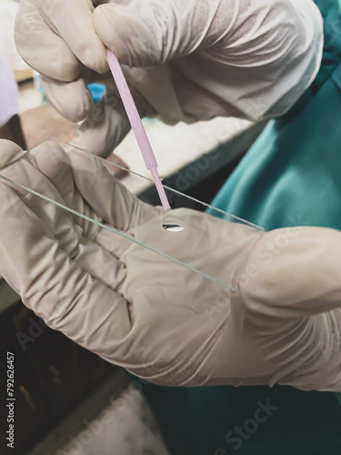 Surgeons hand holding a test tube with blood sample in a hospital. Closeup heath study