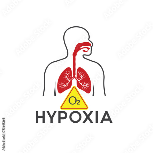 illustration of hypoxia, oxygen levels in cells or body tissues decrease.