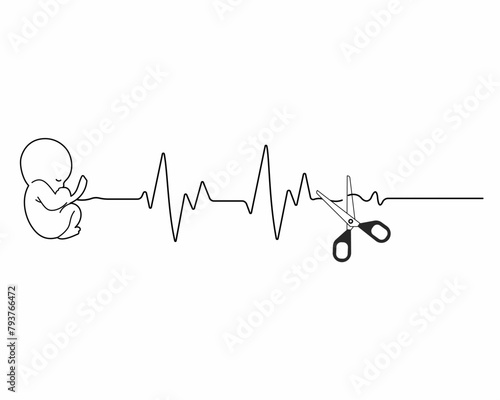 miscarriage or abortion loss pregnancy fetus baby with heart beat pulse cut off with scissors vector illustration
