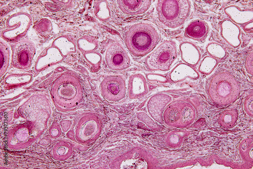 Tissue sample of Bone human, Elastic cartilage human and Red bone marrow under the microscope in Lab.