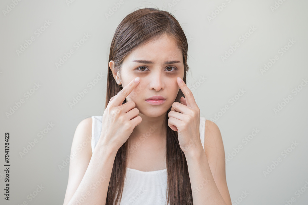 Bored, insomnia asian young woman, girl looking at camera, hand touching under eyes with problem of black circles or panda puffy, swollen and wrinkle on face. Sleepless, sleepy healthcare person. Bored, insomnia asian young woman, girl looking at camera, hand touching under eyes with problem of black circles or panda puffy, swollen and wrinkle on face. Sleepless, sleepy healthcare person.