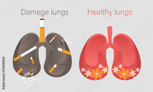 Set of two healthy and damage lungs vector illustration with cigarette.
