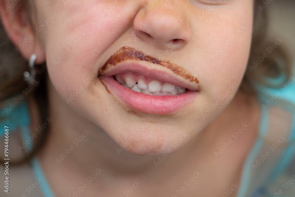 Fototapeta premium Mouth of a Caucasian girl grimacing and chocolate-stained mustache. Close-up photo. Sugary foods in children's diets.