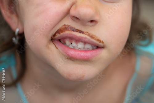 Mouth of a Caucasian girl grimacing and chocolate-stained mustache. Close-up photo. Sugary foods in children's diets.