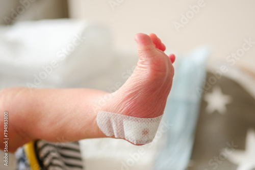 Newborn blood spot or heel prick test (the Guthrie test). bandage on a pinprick puncture in one heel of the newborn to collect their blood in order to screen for inborn metabolic diseases.