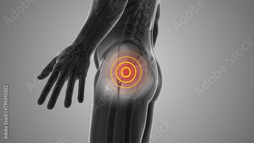 Hip discomfort that triggers pain