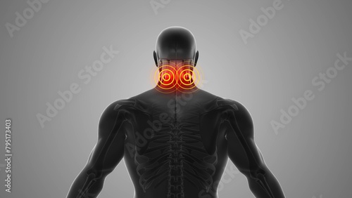 Neck discomfort that triggers pain