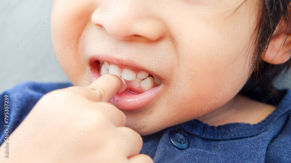 Fototapeta premium closeup Asian toddler points his teeth with finger