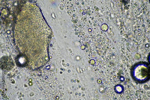 Coughing up mucus and phlegm from a chest infection from a virus and bacteria infection, looking at it under the microscope, with cells and microorganisms. Bacteria and skin cells