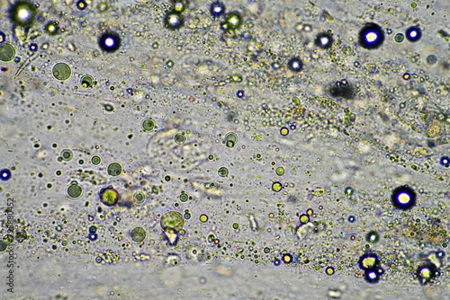 Coughing up mucus and phlegm from a chest infection from a virus and bacteria infection, looking at it under the microscope, with cells and microorganisms. Bacteria and skin cells