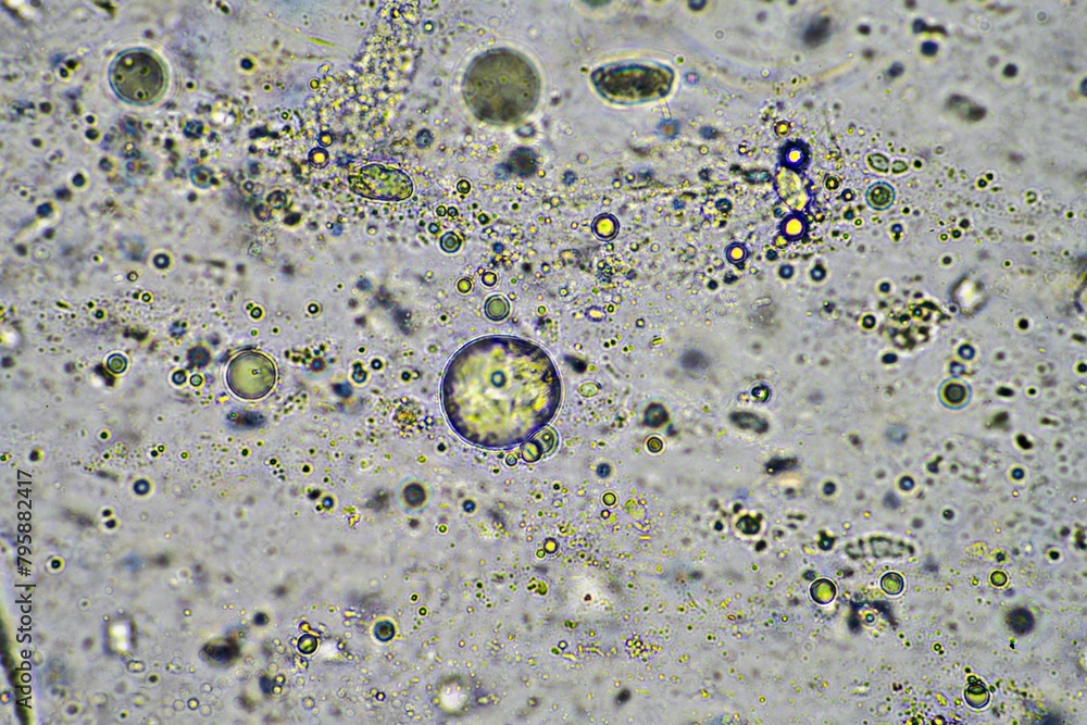 green mucus and coughing up phlegm under the microscope looking at
