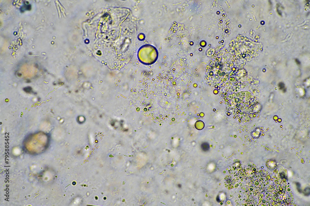 green mucus and coughing up phlegm under the microscope looking at