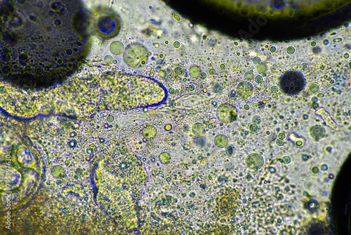 Bild auf Leinwand Coughing up mucus and phlegm from a chest infection from a virus and bacteria infection, looking at it under the microscope, with cells and microorganisms