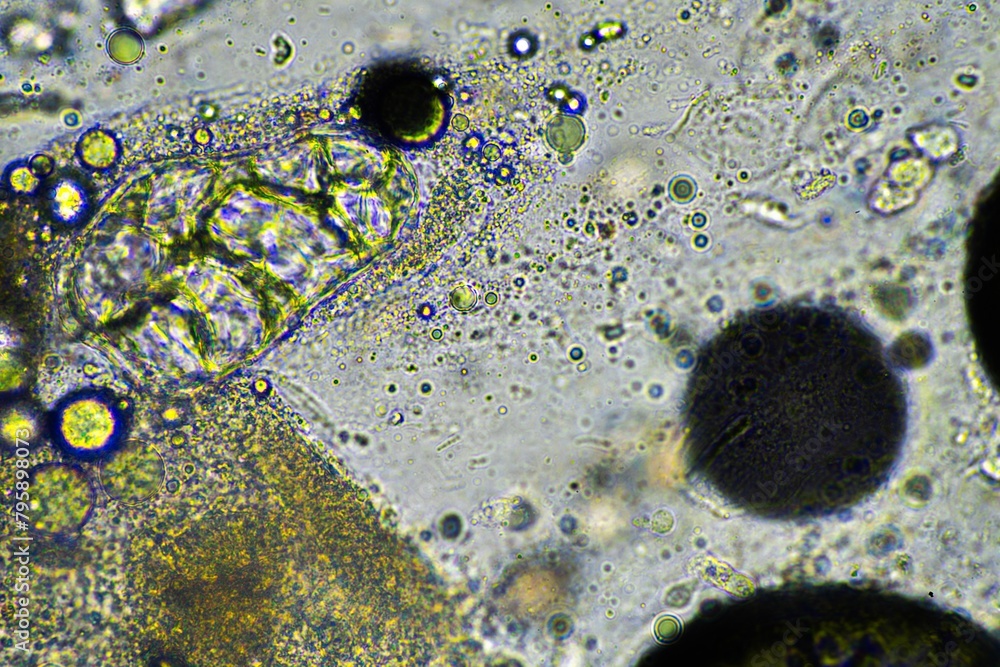 green mucus and coughing up phlegm under the microscope looking at ...