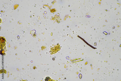fungal hyphae and soil fungi in a soil sample, showing the living soil form a farm