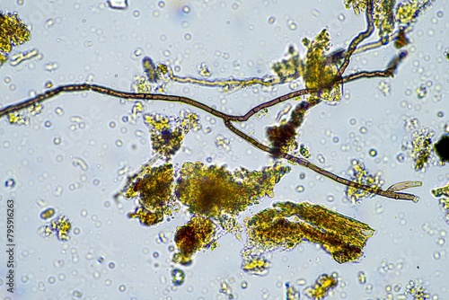 soil microorganisms in a soil life sample from a sustainable agriculture farm. living food web or bacteria fungi and protozoa