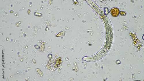 soil microorganisms in a soil life sample from a sustainable agriculture farm. living food web or bacteria fungi and protozoa photo