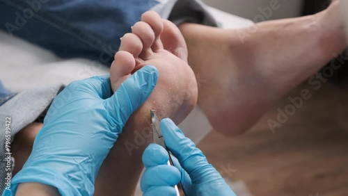 A podiatrist using clippers removes a callus from a womans foot at the medical center.
