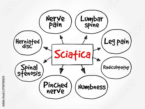 Sciatica - pain, weakness, numbness, or tingling in the leg, mind map text concept background