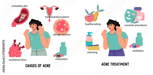 Treatment and causes of acne, skincare informative banner or poster template. Cosmetology and dermatology for acne and inflammation and skin problems, flat vector illustration on white background.
