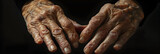 Graphic Visual Depiction of Rheumatoid Arthritis - Symptomatology in Hands