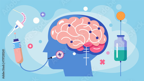A visualization of deep brain stimulation being used to alleviate symptoms of Alzheimers Disease targeting areas of the brain responsible for memory.