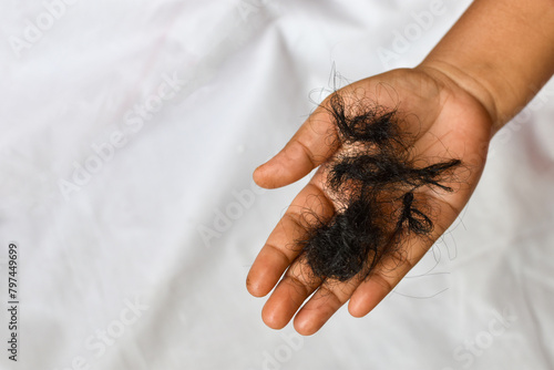 Hair loss, hair fall everyday serious problem, on white background.