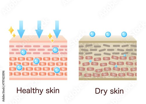 Comparison illustration of skin chart