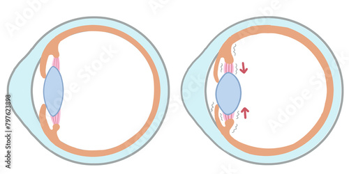 Eye structure cross-sectional diagram illustration