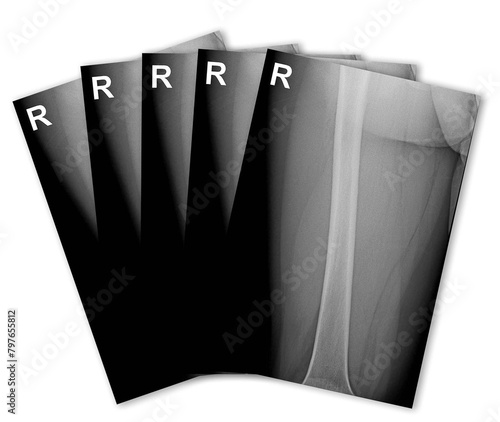 X-ray images spread out with a fan on a white background