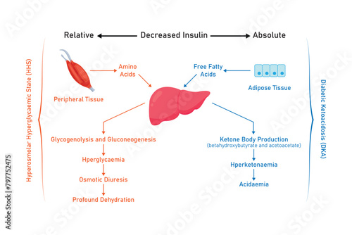 Hyperosmolar Hyperglycemic State (HHS) and Diabetic Ketoacidosis (DKA) Scientific Design. Vector Illustration. photo