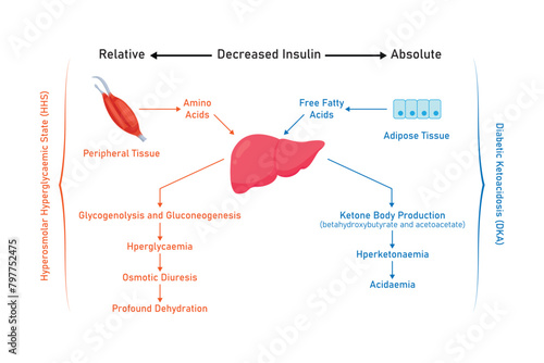 Hyperosmolar Hyperglycemic State (HHS) and Diabetic Ketoacidosis (DKA) Scientific Design. Vector Illustration.