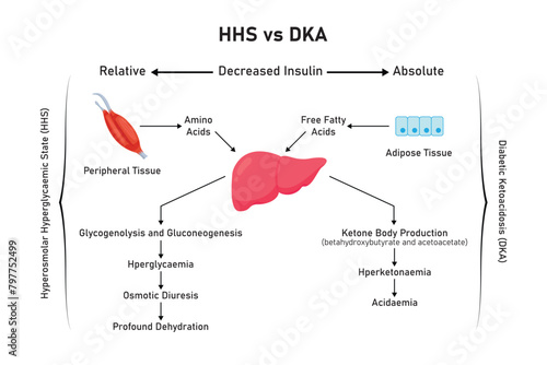 Hyperosmolar Hyperglycemic State (HHS) and Diabetic Ketoacidosis (DKA) Scientific Design. Vector Illustration.