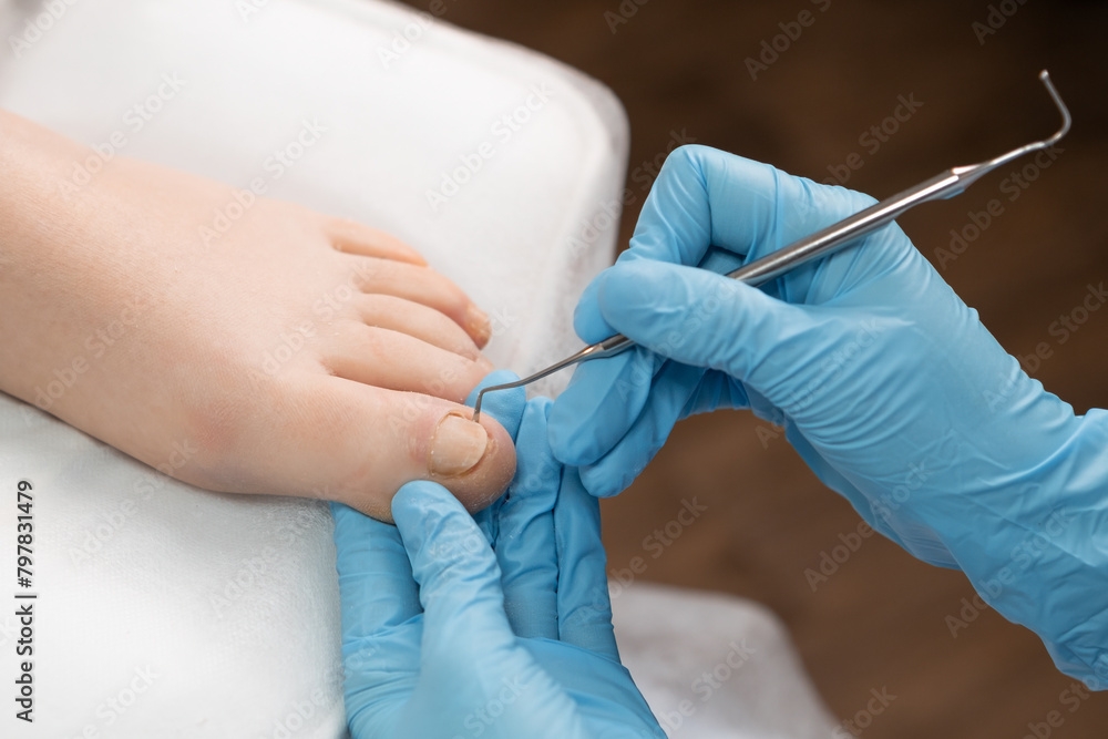 Pedicure master uses nail instrument while toe nails treatment. Pedicure master uses nail instrument while toe nails treatment.