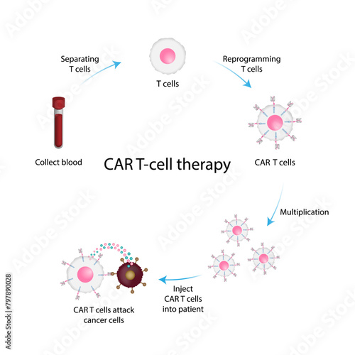 CAR T-cell therapy. Chimeric antigen receptor T cell ,CAR T cell, for use in immunotherapy. Genetic engineering. Chemotherapy. vector illustration. photo
