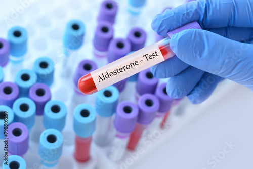 Doctor holding a test blood sample tube with Aldosterone test on the background of medical test tubes with analyzes.