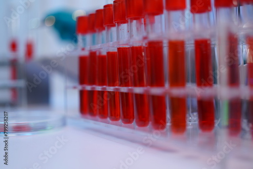 Science test tubes, laboratory equipment for new medical research, microbiology research with small pipettes in close-up. Asian and African female scientists in the laboratory, perfume samples