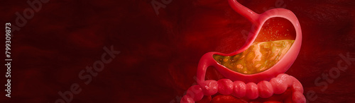 Schilderij op canvas Symptoms of acid reflux or excess acid in the stomach