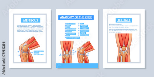 Vector Medical Poster Templates Illustrate Knee Joint Anatomy. Vertical Banners Or Flyers Showcasing Ligaments, Tendons