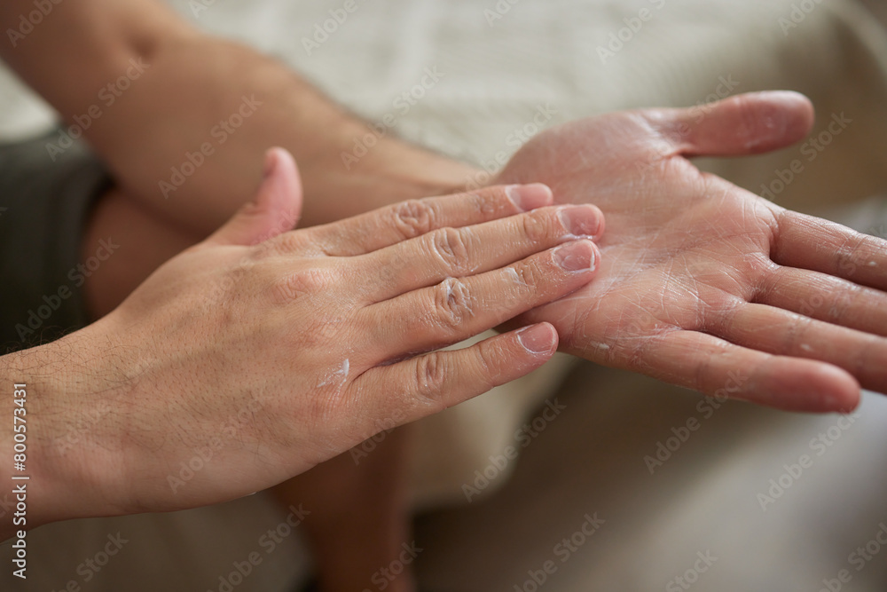 The man's hand, he uses steroids Apply External type. The man's hand, he uses steroids Apply External type.