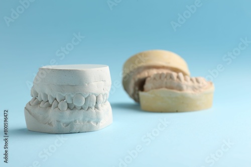 Dental model with gums on light blue background. Cast of teeth photo