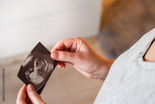 Close up top view of a woman holding a ultrasound picture of her baby photo