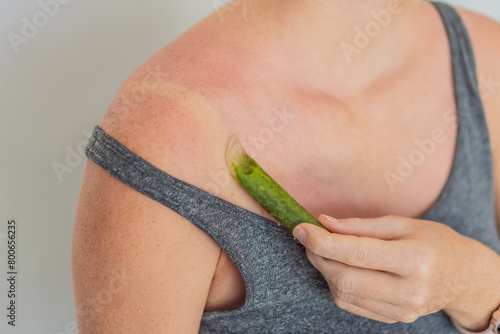Принти на полотні Expectant woman soothes sunburned skin with aloe leaf, embracing natural relief